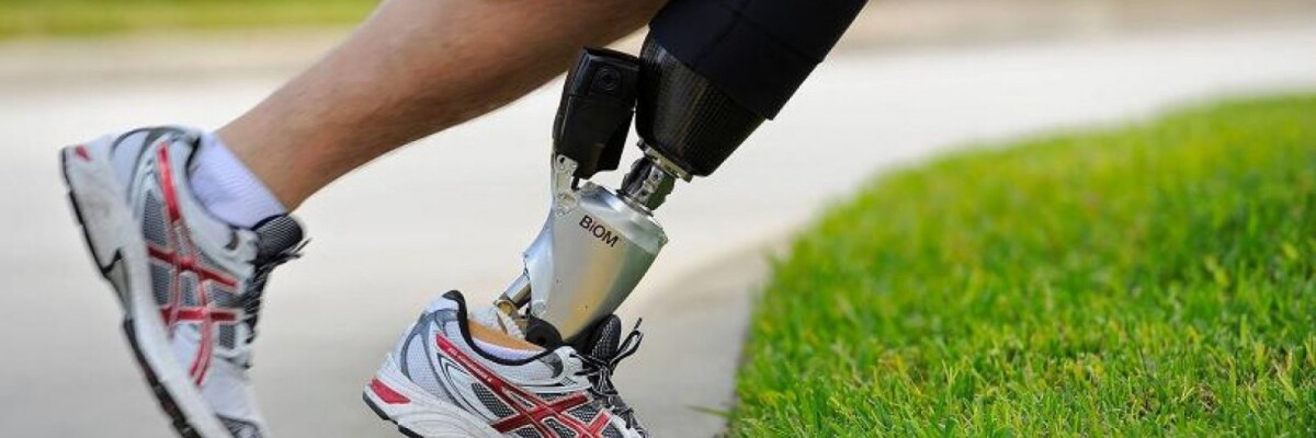 Smart prostheses are around the corner
