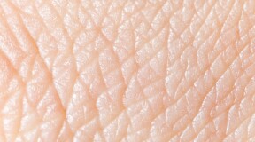 Полная регенерация кожи с помощью трансгенных стволовых клеток