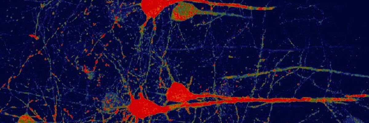 Генная терапия превращает клетки глии в рабочие нейроны