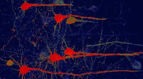 Gene therapy transforms glial cells into functioning neurons 
