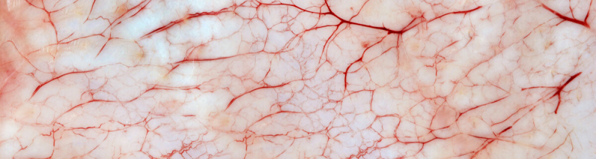 Scientists 3D Print Living Skin Complete with Blood Vessels