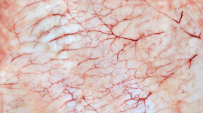 Ученые напечатали живую кожу с кровеносными сосудами