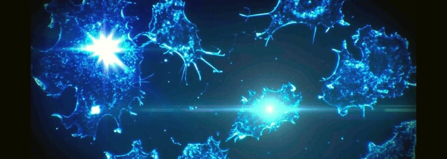 ZAPS laser that kills cancer right through the skin