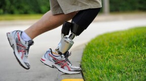 Smart prostheses are around the corner