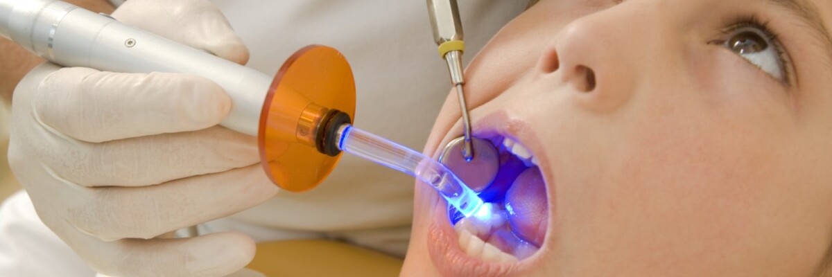 На страже зубов: ученые создали пломбы нового типа