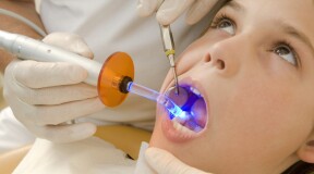 On guard for dental health: scientists develop next-generation fillings