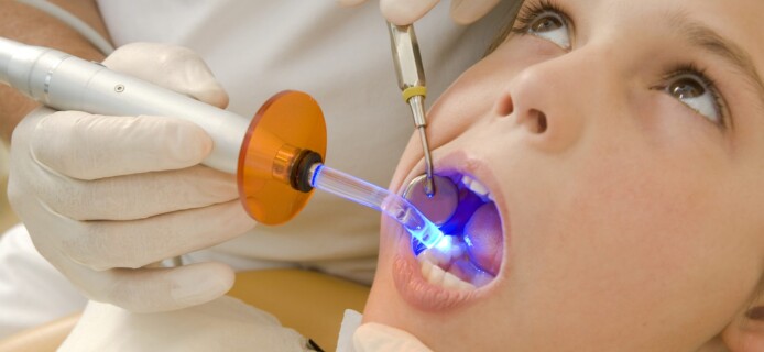 На страже зубов: ученые создали пломбы нового типа