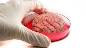 Japanese Scientists Manage to Grow Artificial Brain