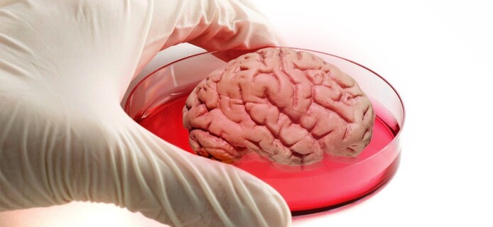 Japanese Scientists Manage to Grow Artificial Brain