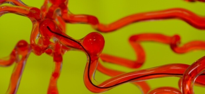 The MIT creates a thread-like robot to remove blood clots from brain vessels