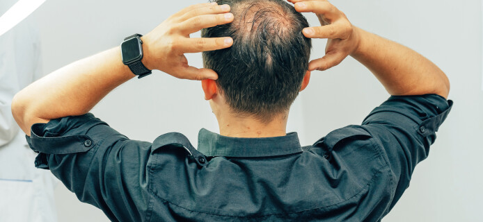 Scientists Create a Compact Device to Stimulate Hair Growth