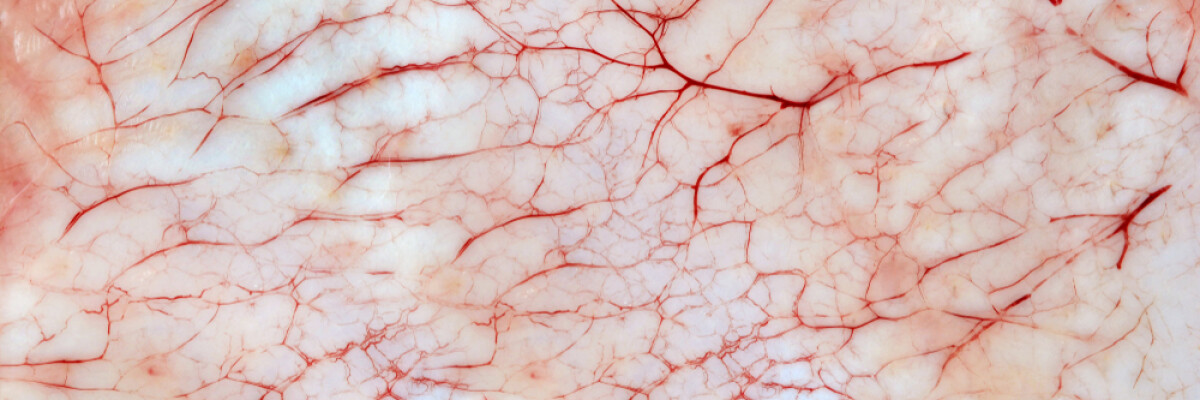 Ученые напечатали живую кожу с кровеносными сосудами