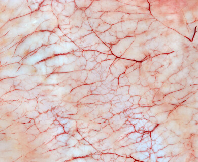 Scientists 3D Print Living Skin Complete with Blood Vessels