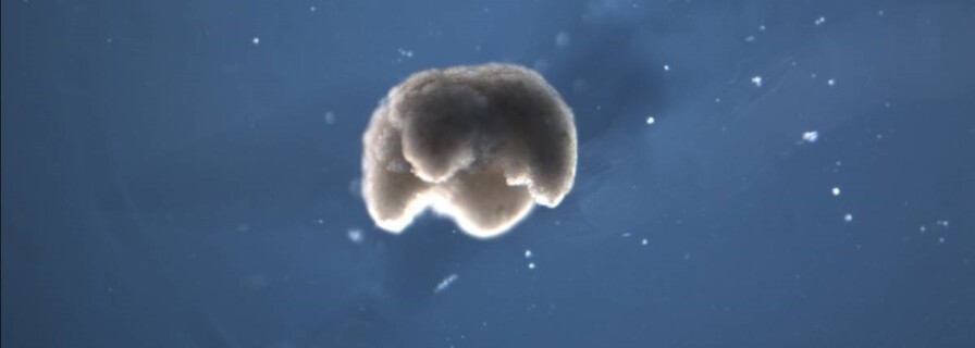 Scientists create xenobots - robots built from living cells 