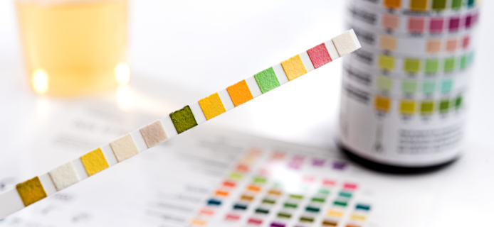 The new method allows you to detect bladder cancer 10 years before clinical signs appear