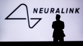 Elon Musk's “smart chip”, telepathy, and the electrical treatment of depression: The things that modern neurobiology can do