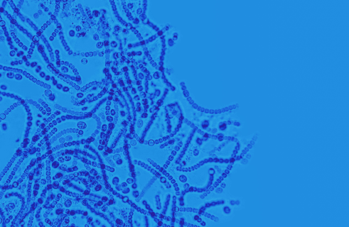 Pharmacist bacterium: scientists have created a microorganism that converts plastic into medicine