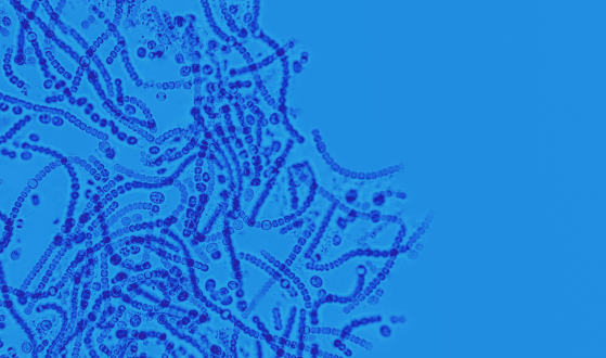 Pharmacist bacterium: scientists have created a microorganism that converts plastic into medicine