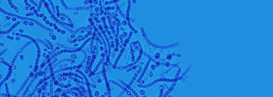 Pharmacist bacterium: scientists have created a microorganism that converts plastic into medicine