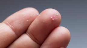 Scientists Confirm That the More Often We Open and Close Plastic Bottles, the More Microplastics Enter the Water