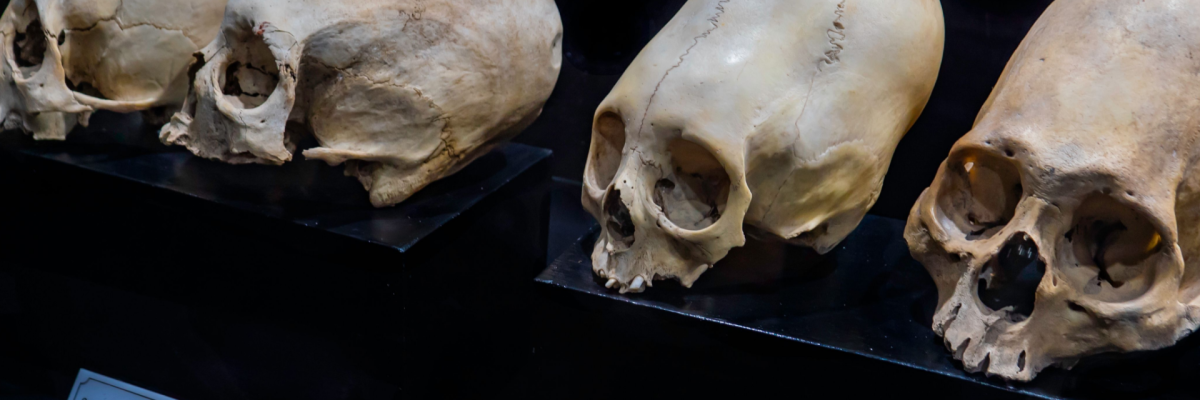 Mysterious Cone: Skull Found in Peru Puzzles Scientists