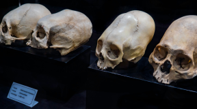 Mysterious Cone: Skull Found in Peru Puzzles Scientists