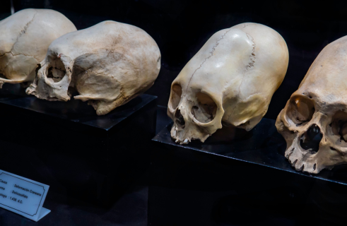 Mysterious Cone: Skull Found in Peru Puzzles Scientists
