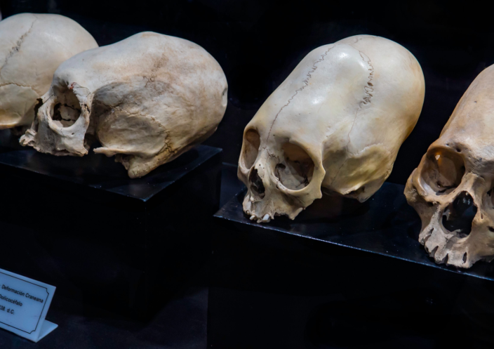 Mysterious Cone: Skull Found in Peru Puzzles Scientists