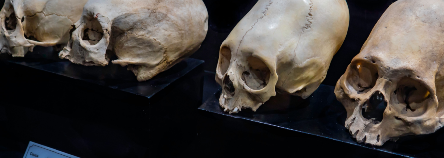 Mysterious Cone: Skull Found in Peru Puzzles Scientists